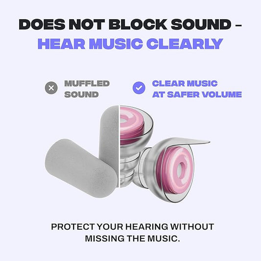 Zound Concert Earplugs Cosmic Blush - Reduces Loud Noise But Does Not Muffle Sound, Hear Music Clearly & Safely at Concerts & Festivals - Reusable, Comfortable Hearing Protection with Case