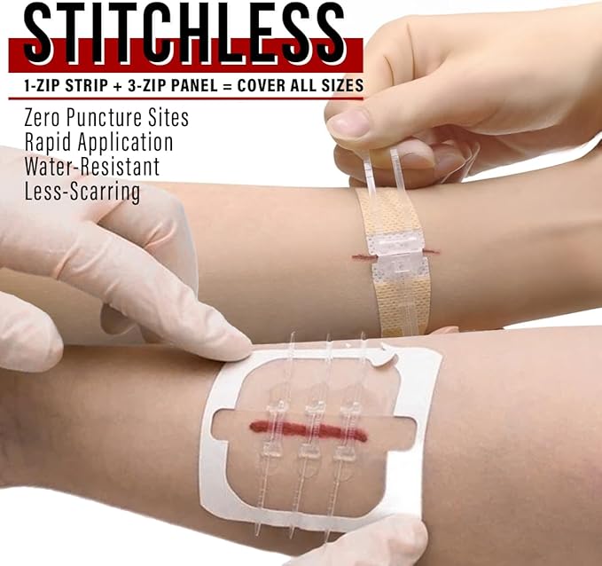 EVERLIT Wound Closure Kit | Surgical Zip-Stitch Devices for Cut & Laceration | Sterile, Suture-Free, Stitch-Less Adhesive Butterfly Bandages for Emergency First Aid Wound Care (6 Zip Complete Kit)