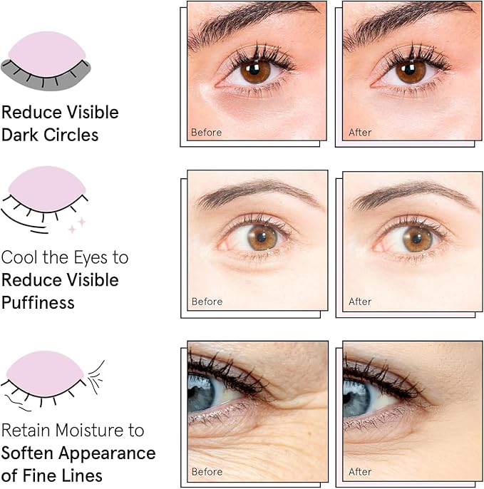 grace & stella Under Eye Patches (12 pairs) Eye Masks for Puffy Eyes and Dark Circles - Stocking Stuffers for Teen Girls, Christmas Gifts for Women, White Elephant Gifts, Birthdays, Holidays - Vegan