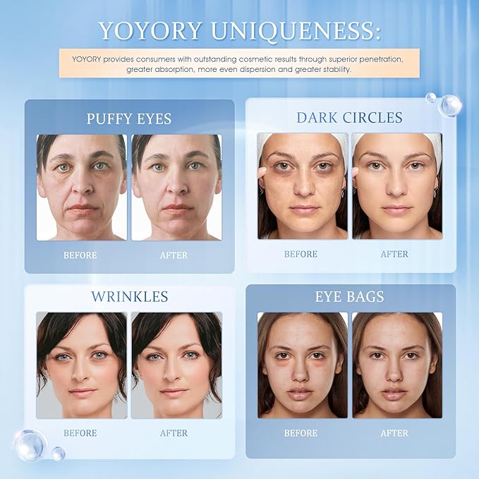 Under Eye Patches Masks - for Dark Circles, Puffy Eyes, Fine Lines, Wrinkles, Eye Bags Treatment with Collagen and Hyaluronic Acid,Firming & Cooling, Moisturizing and Hydrating (60 Pcs) Blue